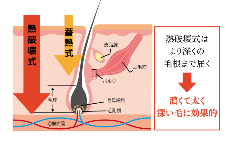 ベクタスとは
